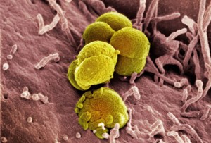 Gonorrhea bacteria
