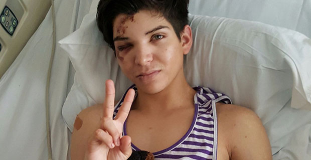 Anthony Villegas, 23, in the hospital after an assault in West Hollywood.